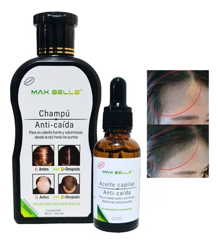 🔥 Pack CreceLux®: Frena la Caída, Acelera el Crecimiento + Shampoo GRATIS 🚀🌿